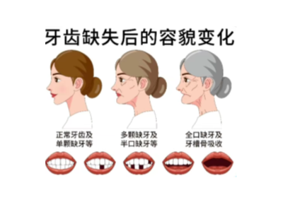 【科學(xué)科普】十個(gè)常用的口腔小知識(shí)！