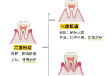 老年人牙齒松動了要怎么辦？