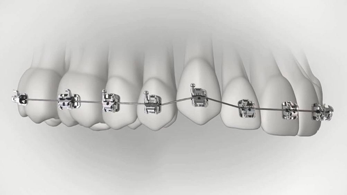 承德市哪家口腔醫(yī)院口腔正畸做得好？惟德口腔醫(yī)院來告訴您
