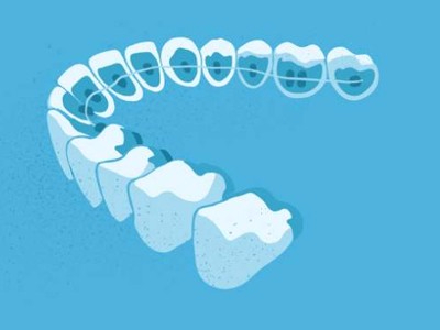 惟德口腔醫(yī)院口腔正畸好不好？