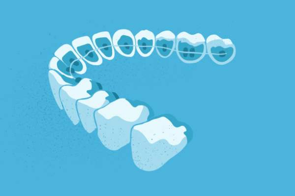 惟德口腔醫(yī)院口腔正畸好不好？